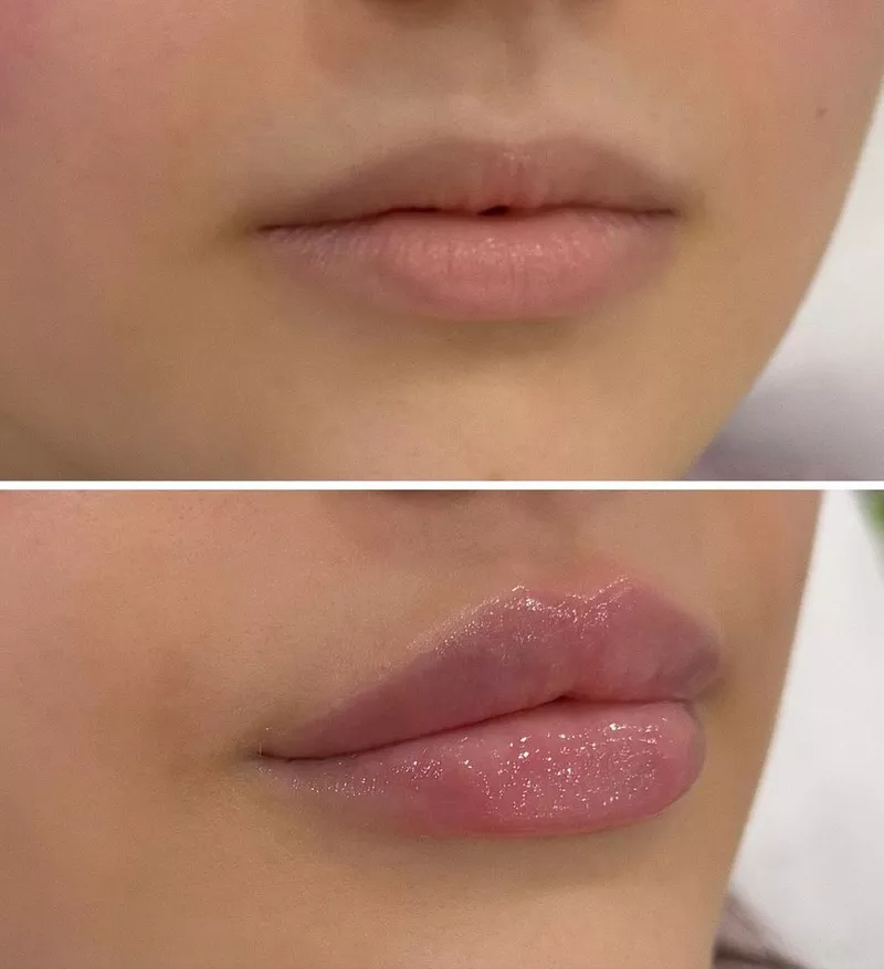 Красота начинается с заботы о себе 3